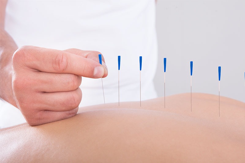Acupuntura Sistêmica