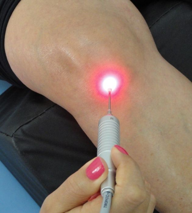 Laserterapia